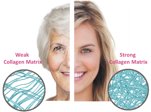 Biosil collagen matrix